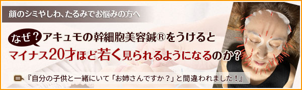 顔のシミやしわ、たるみでお悩みの方へなぜ?アキュモの幹細胞美容鍼をうけるとマイナス20才ほど若く見られるようになるのか?『自分の子供と一緒にいて「お姉さんですか?」と間違われました!』
